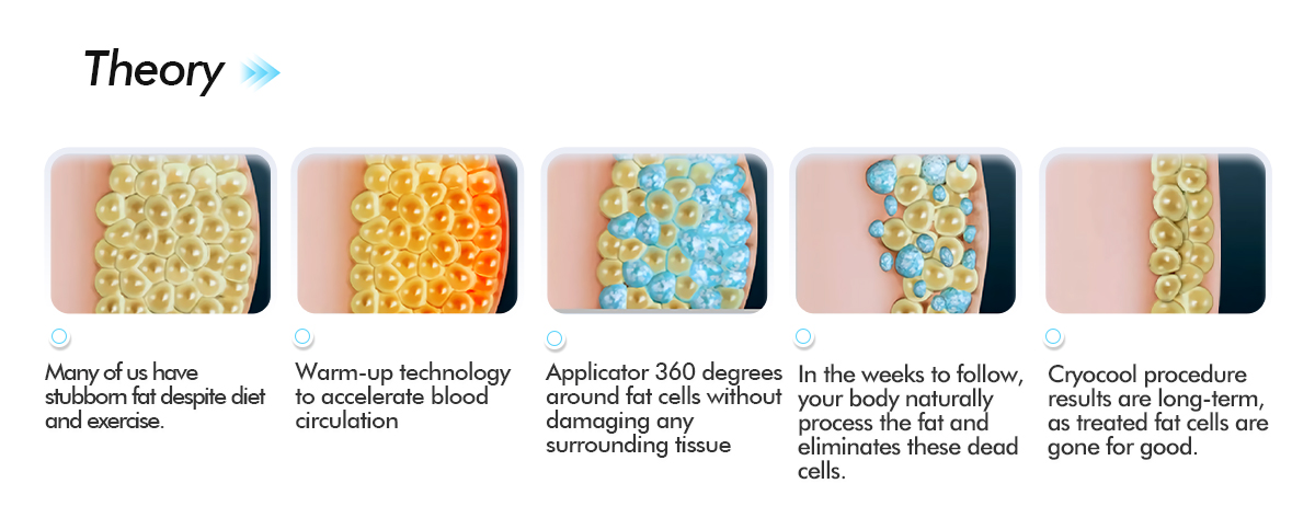 cryolipolysis fat freezing machine