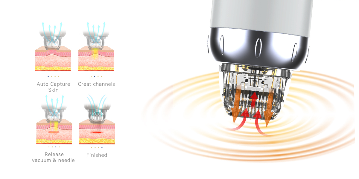 Portable Vacuum RF Microneedling Machines